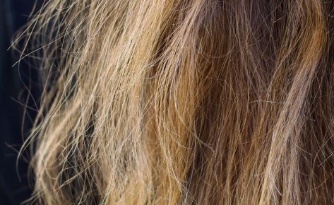Poor Hair Health