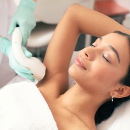 woman getting laser hair removal treatment at NuIQ med spa in Cleveland