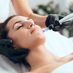 woman getting microneedling facial treatment