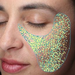 visia skin analysis - texture