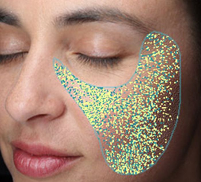 visia skin analysis - texture