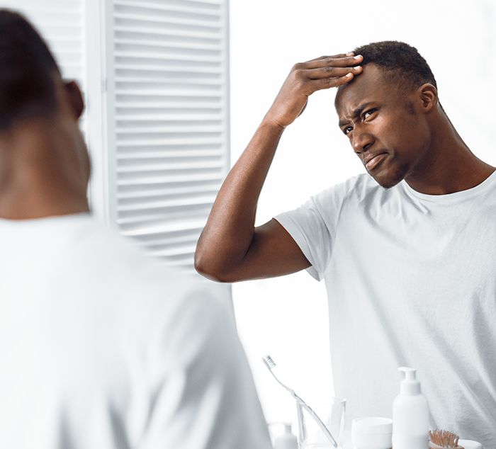man seeing receding hairline and considering a hair doctor near me in Cleveland