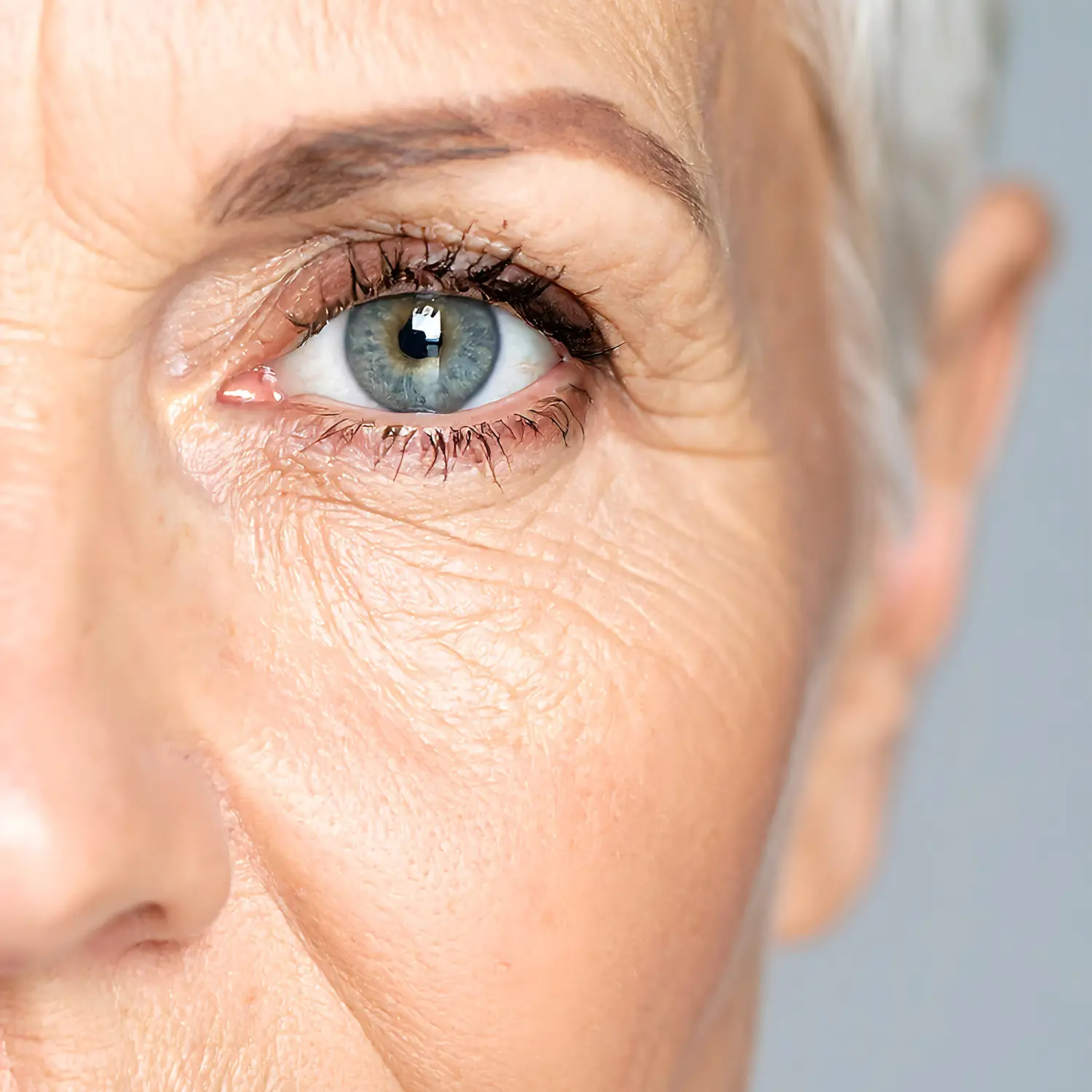 photo of aging woman with temple hollowing - a treatable concern at NuIQ Cleveland