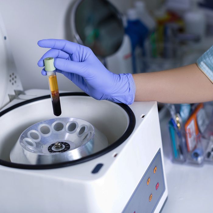 woman performing wellness lab panel testing