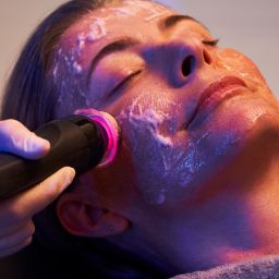 woman getting Glo2facial