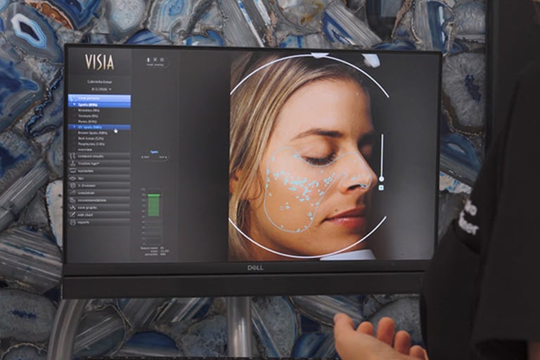 woman reviewing visia skin analysis during aesthetic consultation