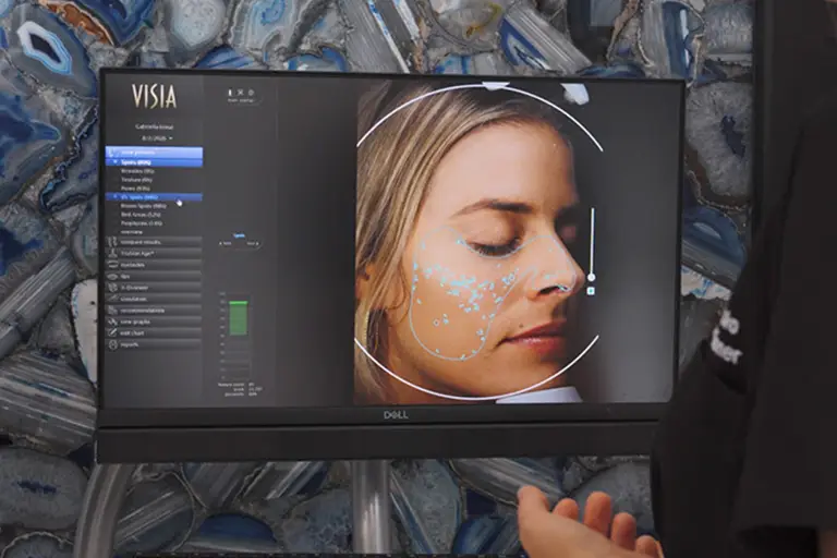 woman reviewing visia skin analysis during aesthetic consultation